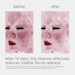 EltaMD Trial Size Skin Recovery Amino Acid Foaming Cleanser