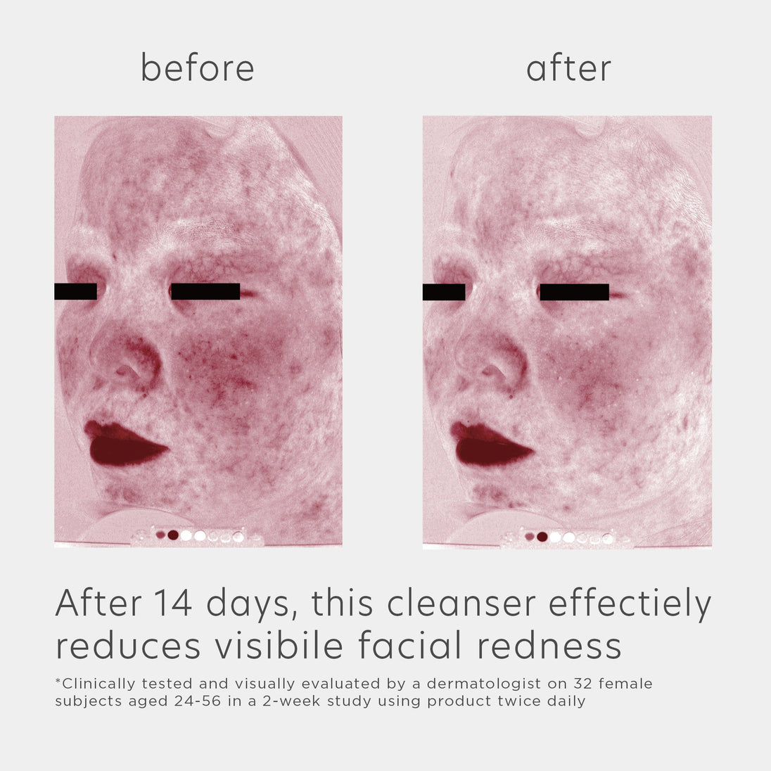 EltaMD Trial Size Skin Recovery Amino Acid Foaming Cleanser