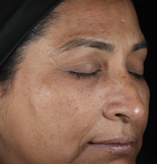 LUMIVIVE® System