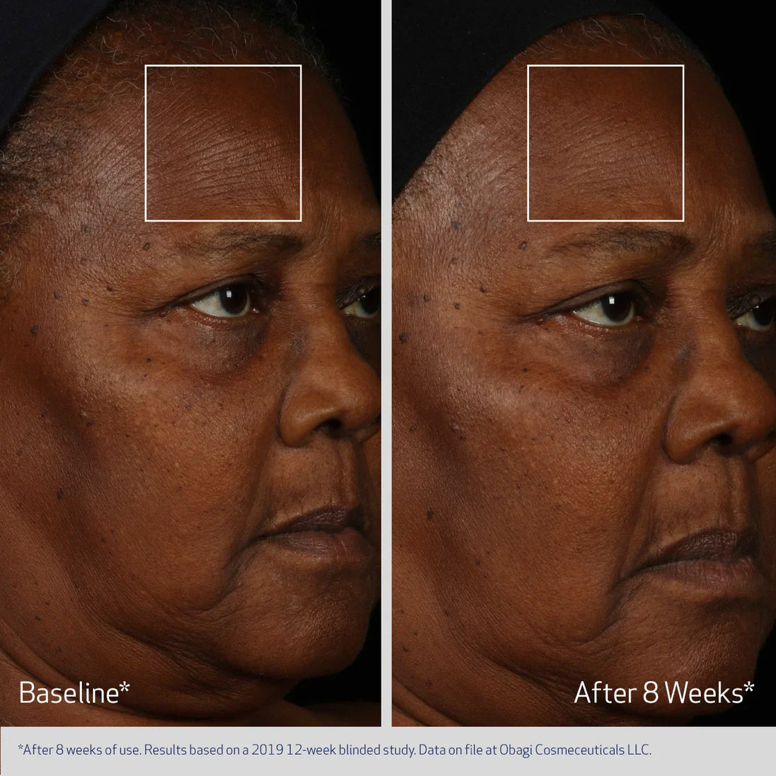 FACIAL SERUM
