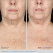 NECK AND DÉCOLLETÉ CONCENTRATE