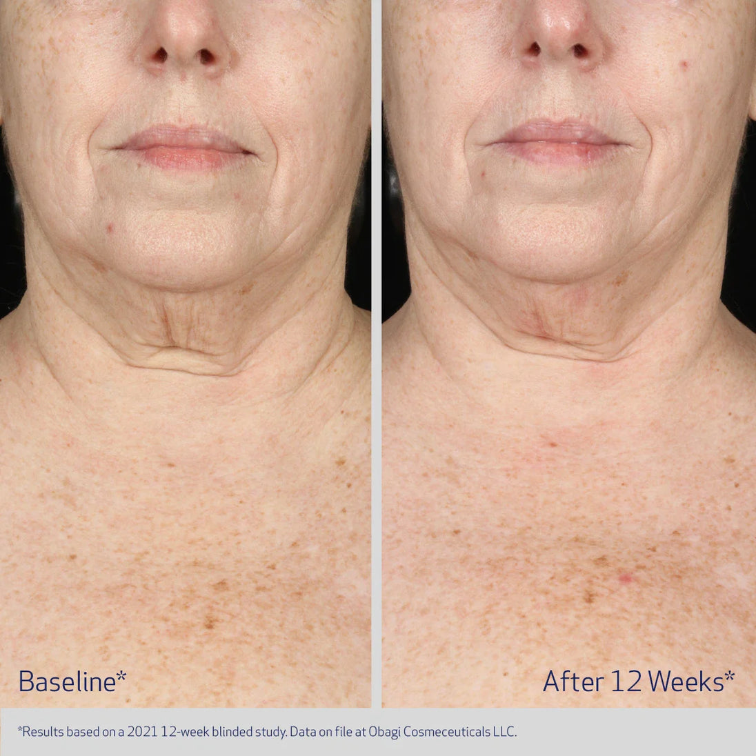 NECK AND DÉCOLLETÉ CONCENTRATE