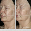 FACIAL SERUM