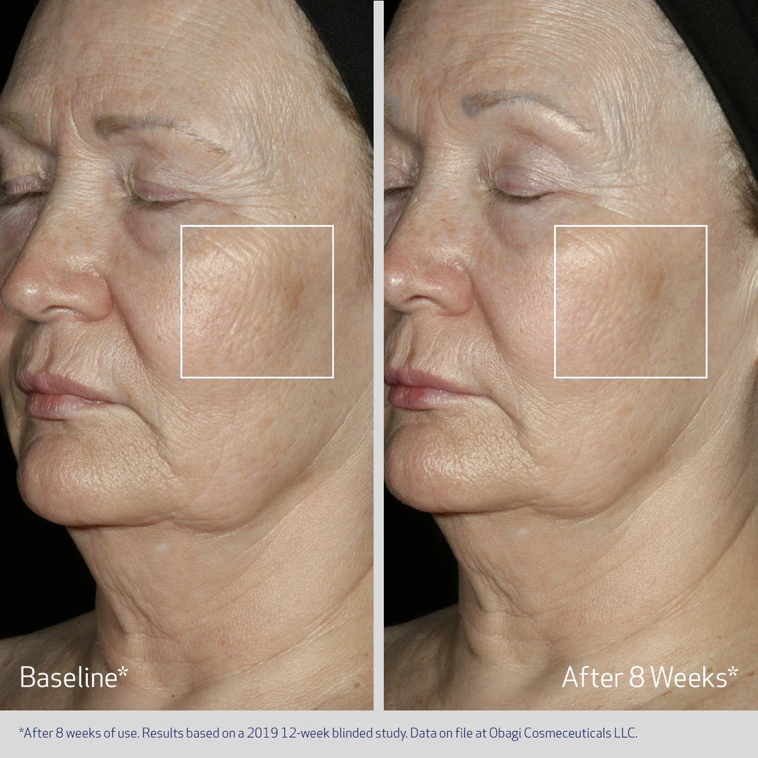 FACIAL SERUM