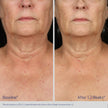 NECK AND DÉCOLLETÉ CONCENTRATE