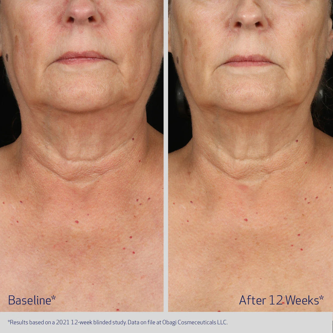 NECK AND DÉCOLLETÉ CONCENTRATE