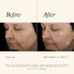 SkinMedica TNS Advanced+ Serum - Our Premium Facial Skin Care Product, the Secret to Flawless Skin. Age-Defying Face Serum for Women is Proven to Address Wrinkles and Fine Lines for Glowing Skin,1 Oz