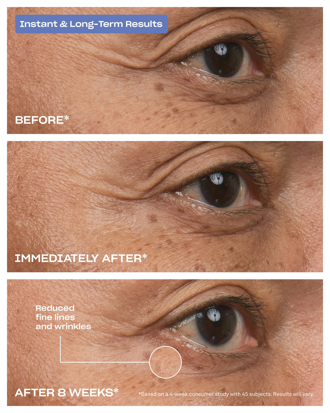 Eye Bright Under-Eye Serum