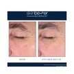 Skinbetter Science EyeMax AlphaRet Overnight Cream