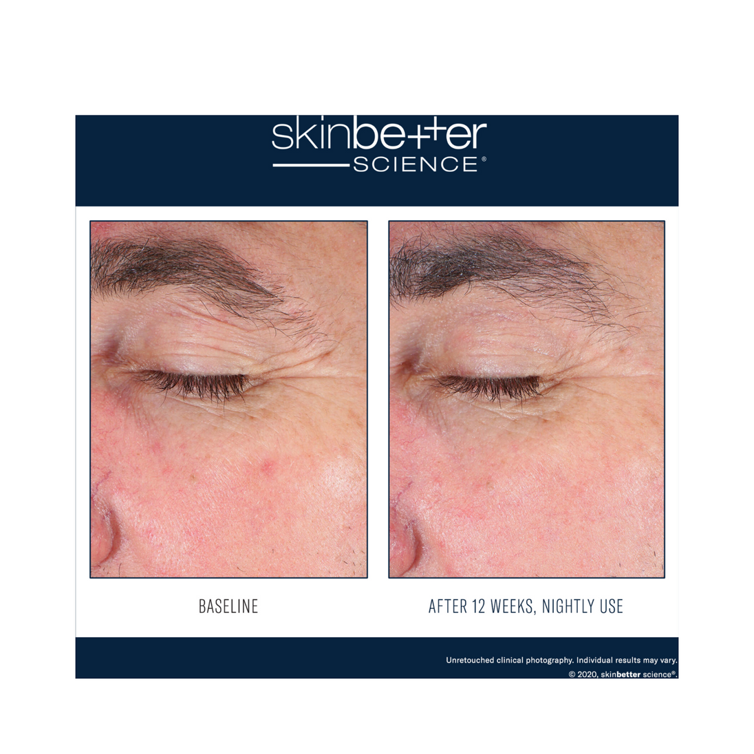 Skinbetter Science EyeMax AlphaRet Overnight Cream