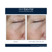 Skinbetter Science Instant Effect Gel Eye