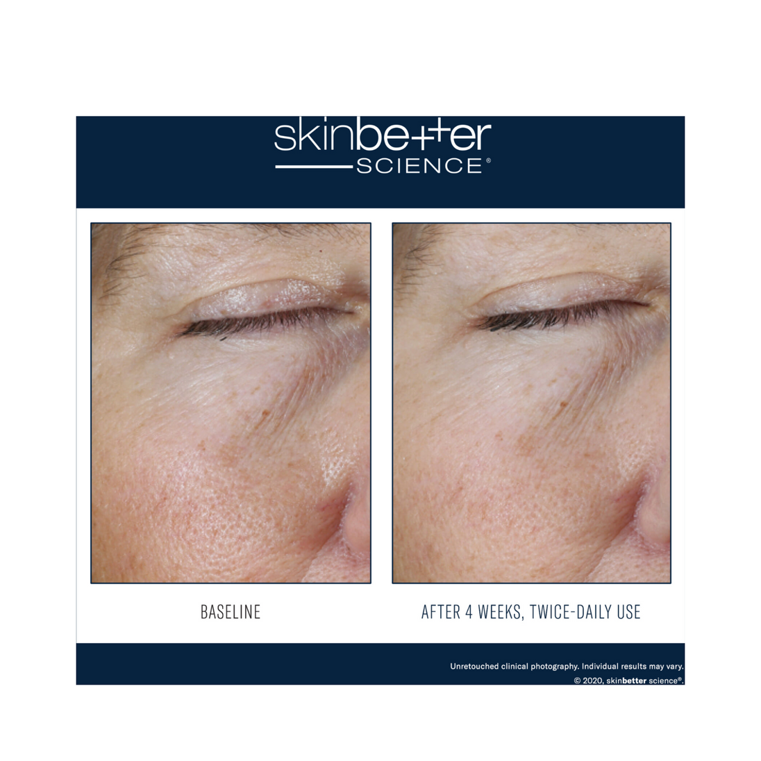Skinbetter Science Instant Effect Gel Eye
