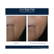 Skinbetter Science Interfuse Intensive Treatment Lines