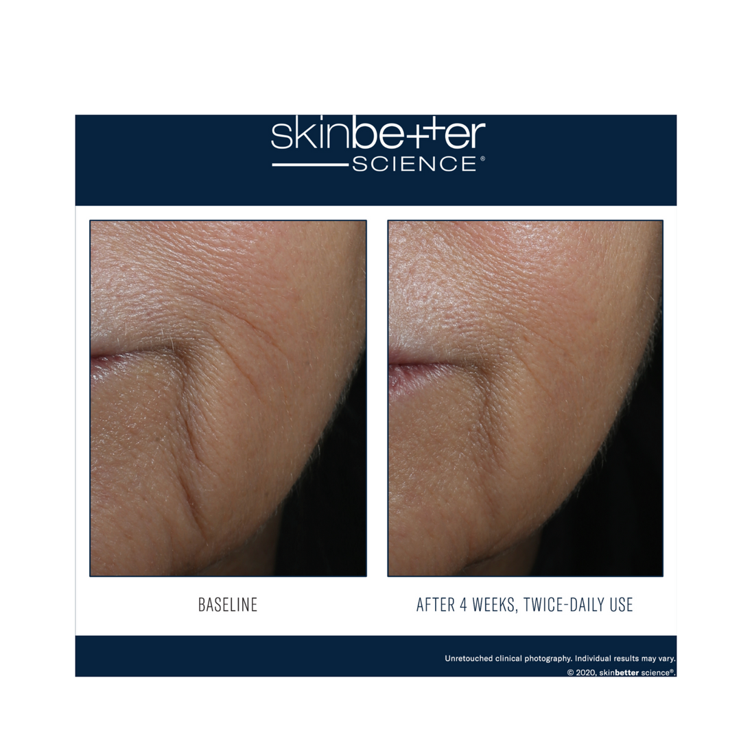 Skinbetter Science Interfuse Intensive Treatment Lines