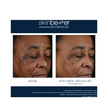 Skinbetter Science Mystro Active Balance Serum