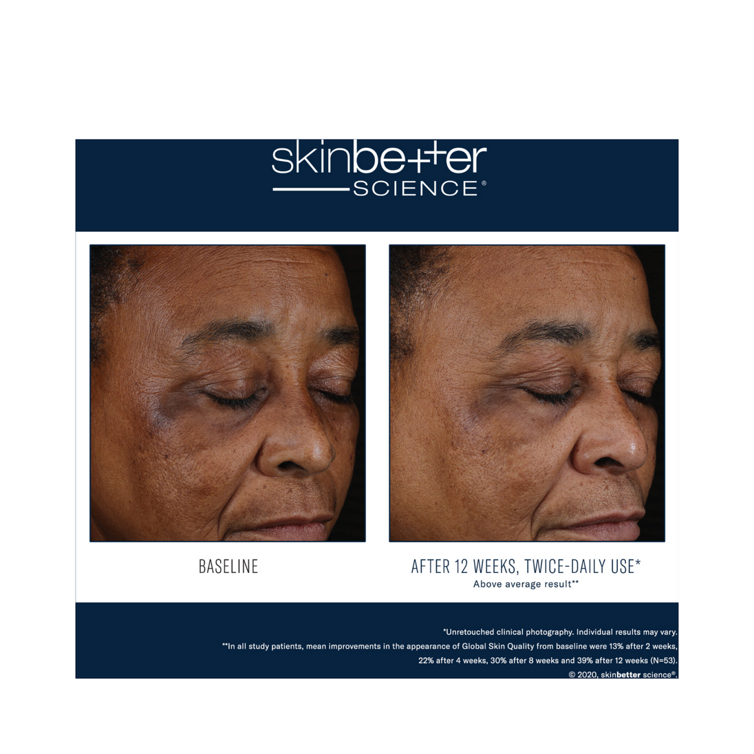 Skinbetter Science Mystro Active Balance Serum