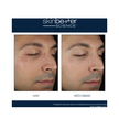 Skinbetter Science Solo Hydrating Defense