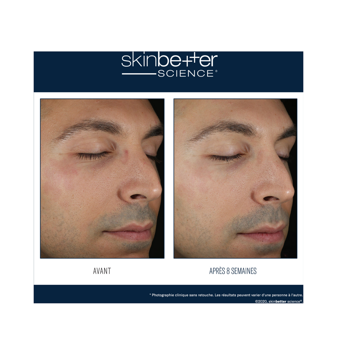 Skinbetter Science Solo Hydrating Defense