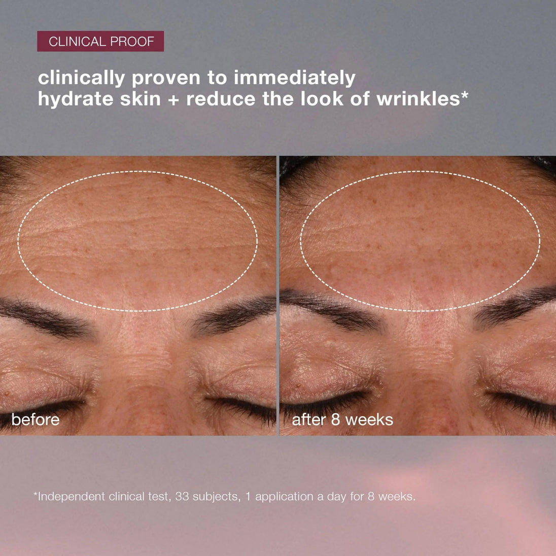 Dynamic Skin Recovery Spf50 Moisturiser